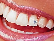 Установка украшений